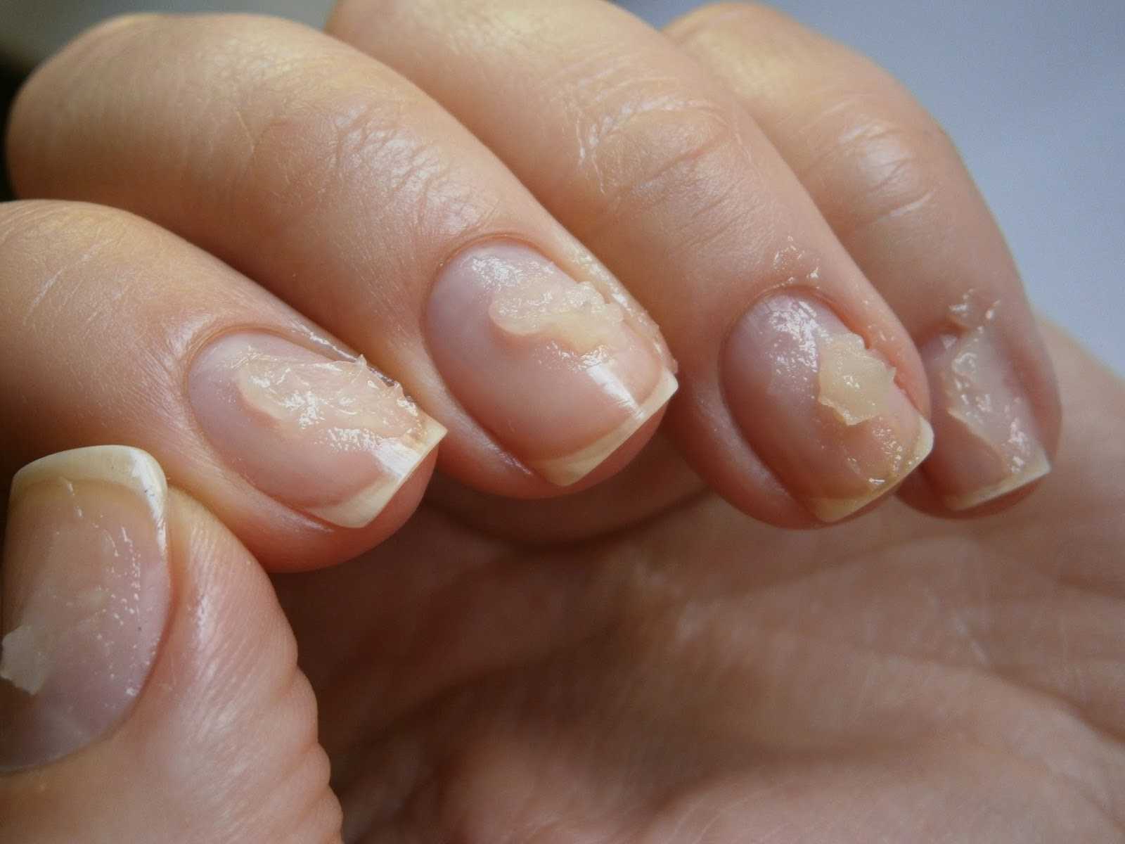 Почему гель-лак мягкий на ногтях. почему гель-лак не держится на ногтях, причины и их устранение