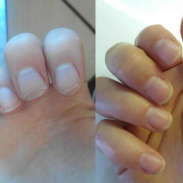 Как восстановить ногти после гель лака - 90 фото реконструкции ногтевой пластины