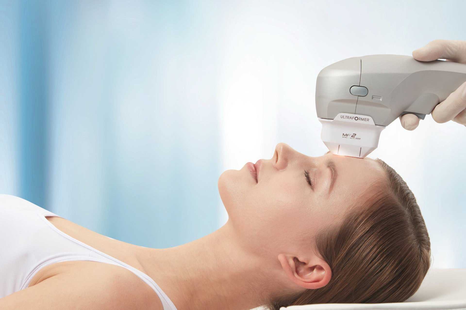 Показания к установке и преимущества нитей softlift