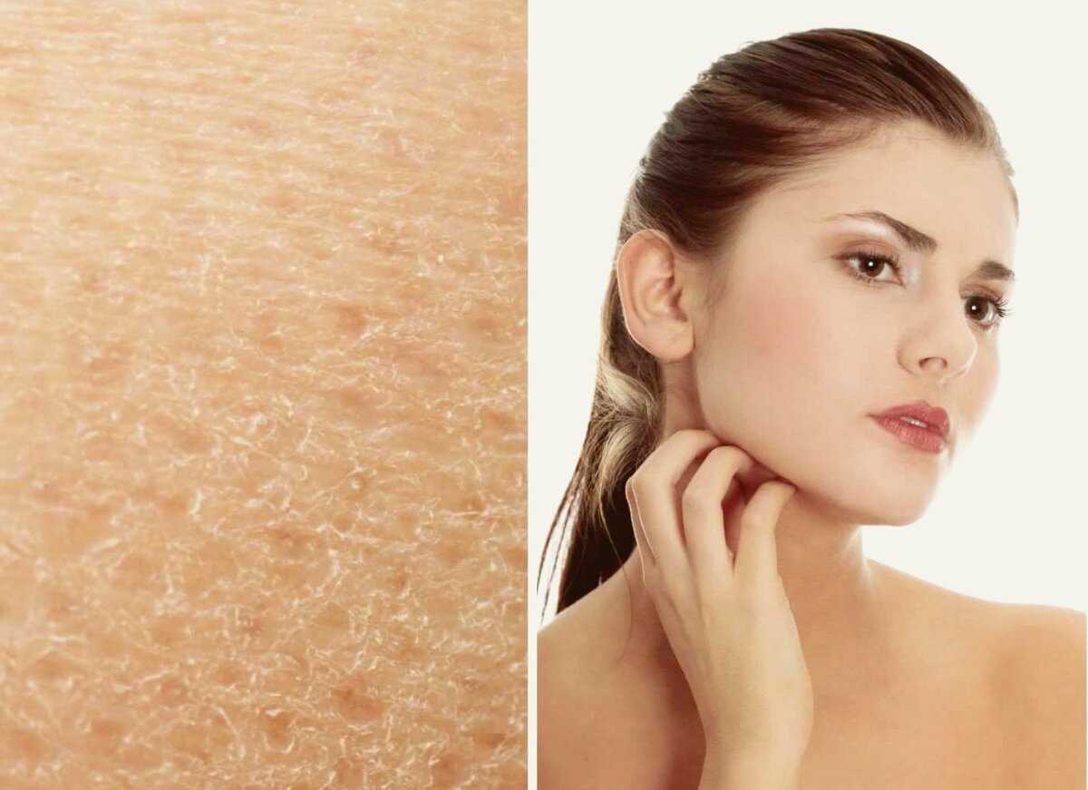 Шелушится кожа на лице. причины шелушения кожи на лице у мужчин и женщин. что делать, если шелушится кожа на лице :: polismed.com