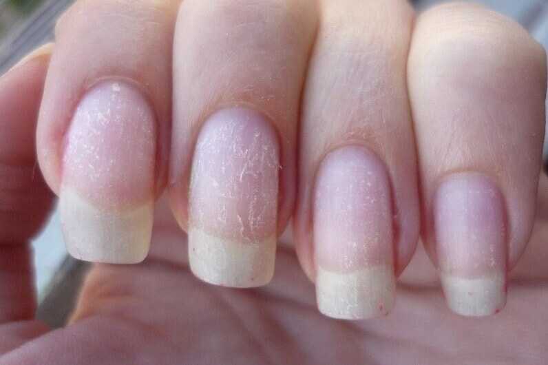 Как восстановить ногти после гель лака? способы восстановить ногти различными средствами