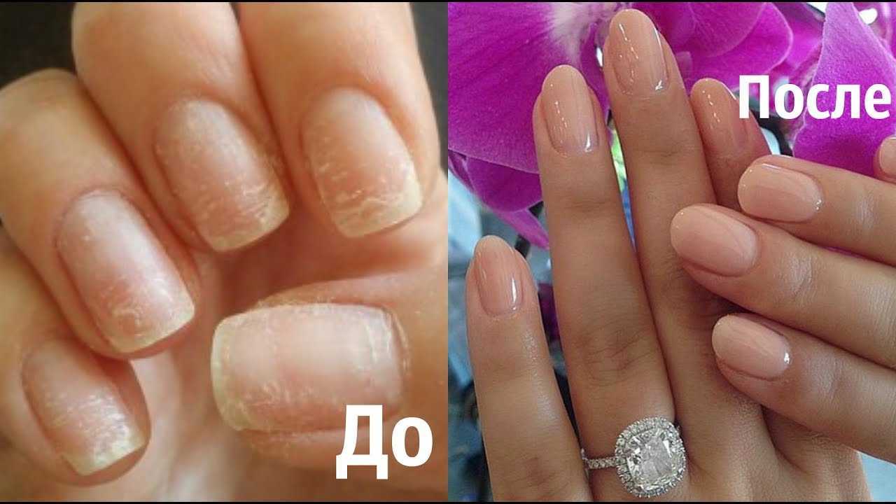 Как восстановить ногти после гель лака - ezavi.ru