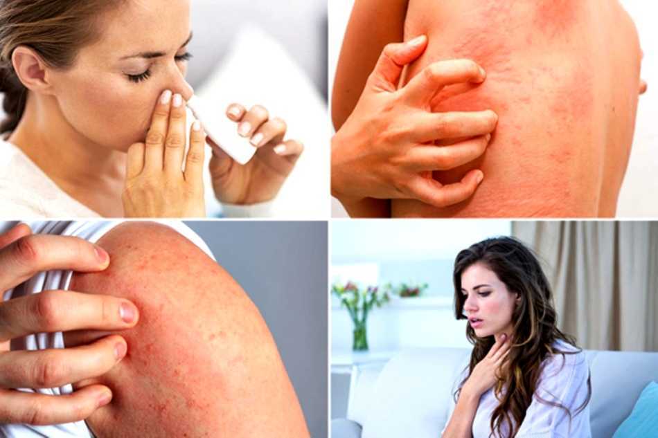 Топ-7 лучших солнцезащитных кремов и спреев с spf 50