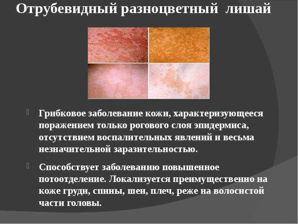 Средства la roche-posay для чувствительной кожи: обзор 3 косметических средств