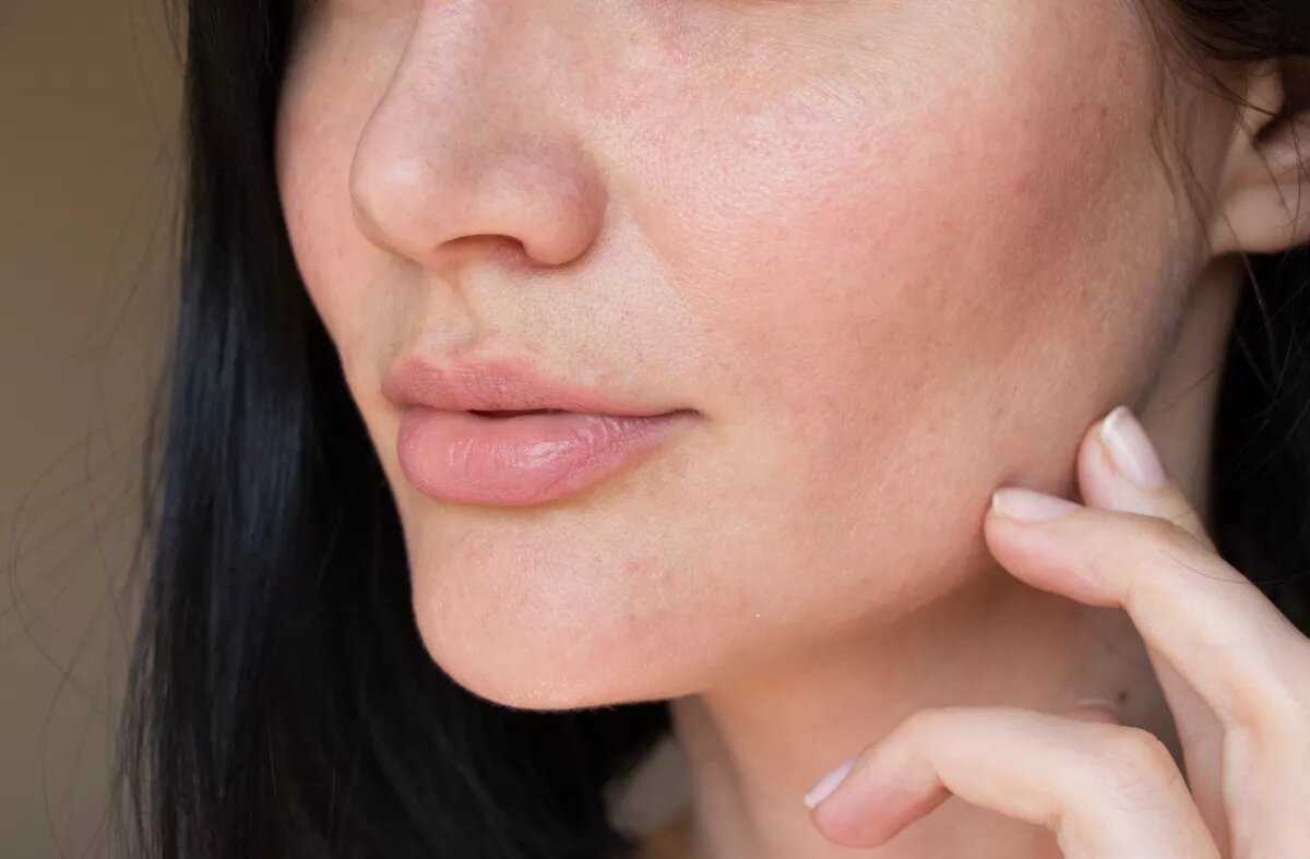 Обезвоженная кожа лица: как быть и что делать - beauty hub