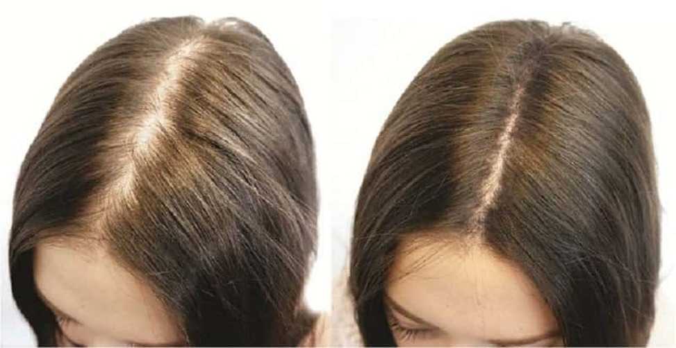 ▷ длинные волосы выпадают больше чем короткие? – clinicana