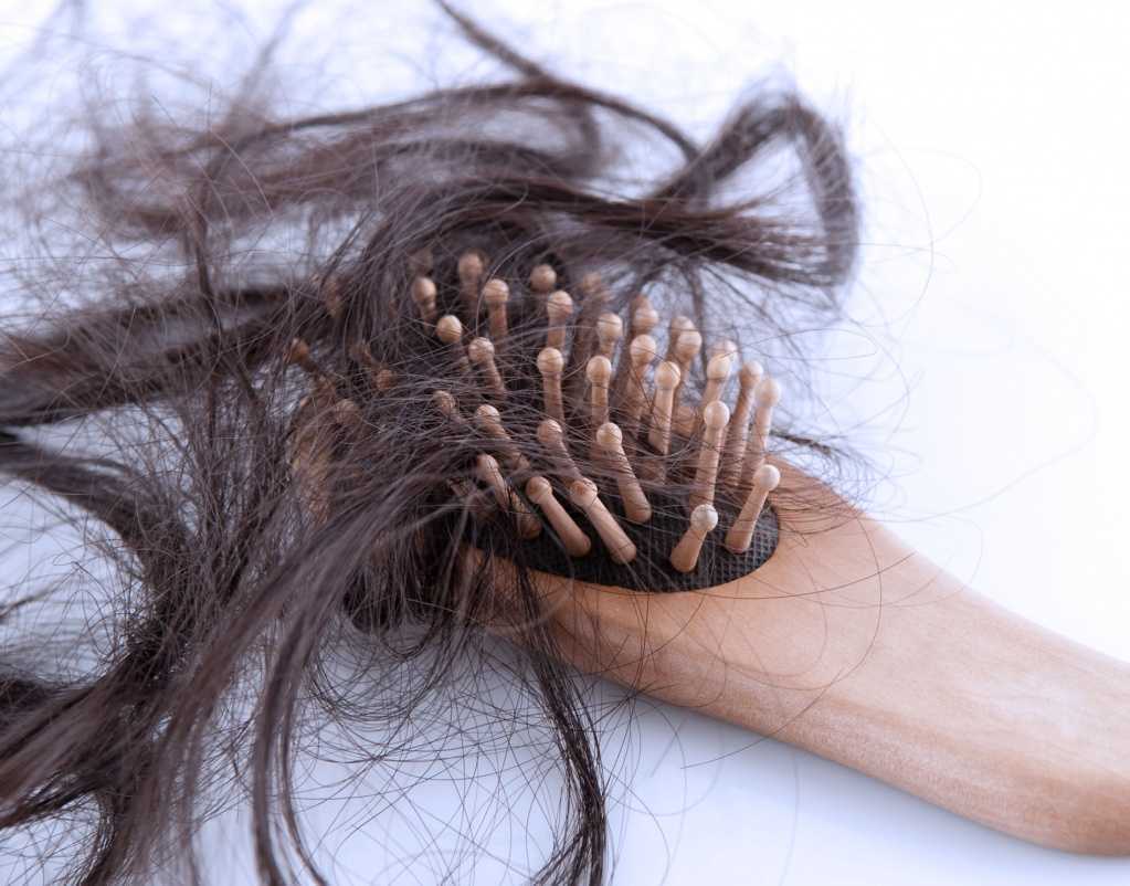 Перхоть на голове: как избавиться и что делать