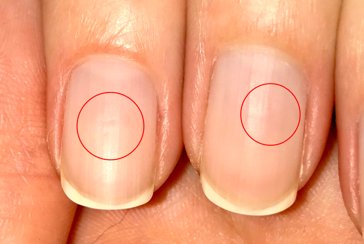 Желтые ногти выглядят болезненно и неопрятно Выясняем, почему ногти желтеют и как можно справиться с этой проблемой в домашних условиях